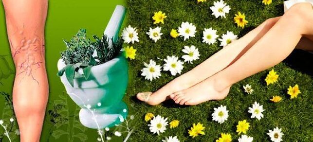 Folk remedies for varicose veins in the legs, contributing to a speedy recovery